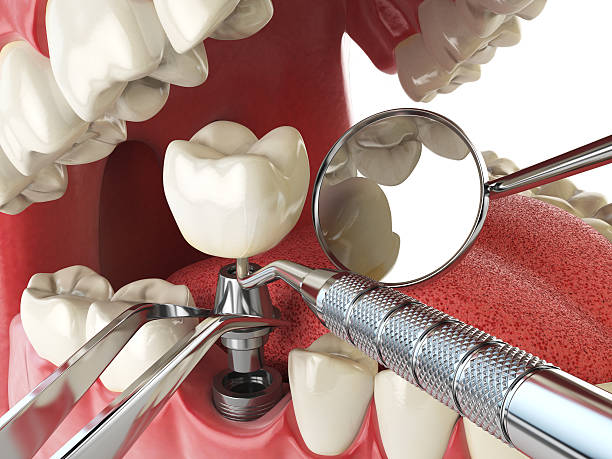 Best Emergency Broken Tooth Repair in Waukomis, OK